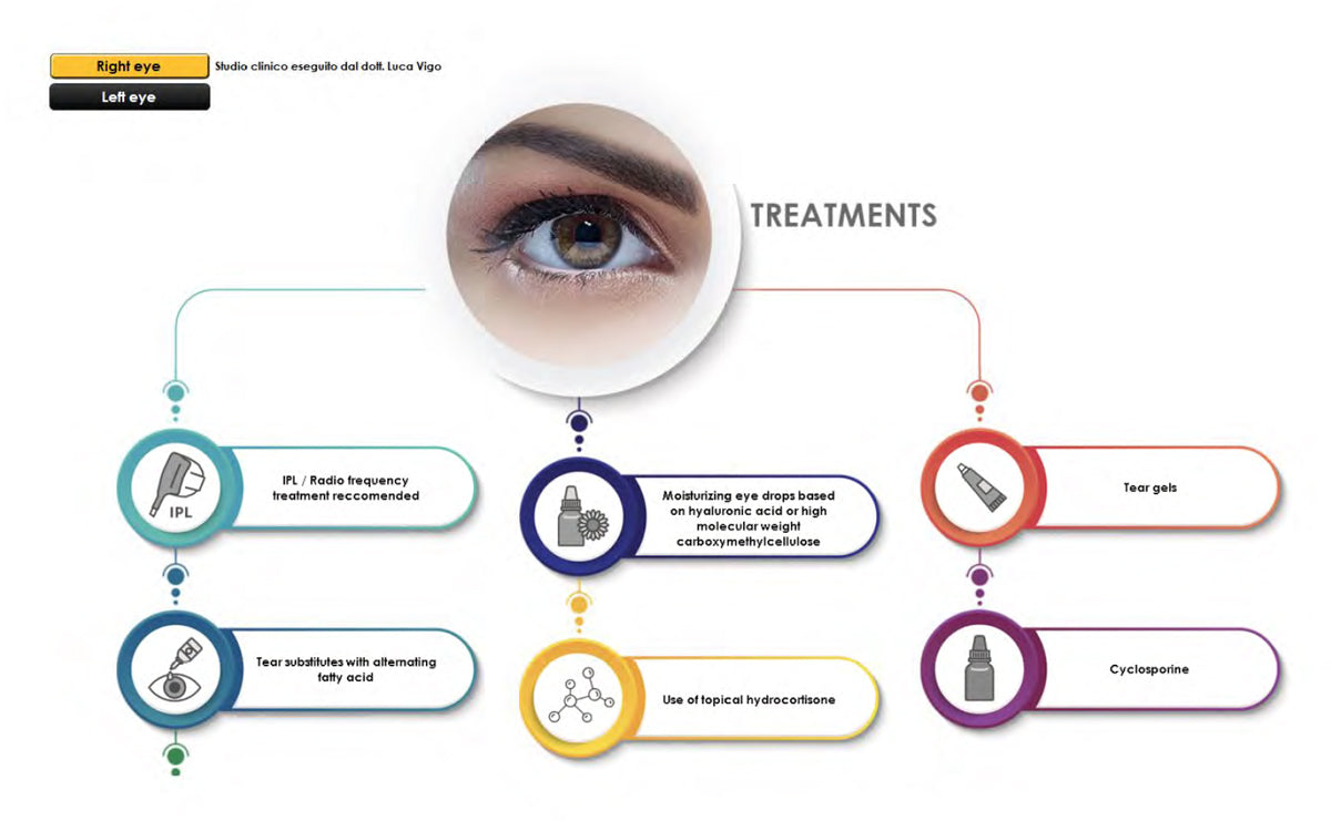 Ezer Dry Eye Sapphire A
