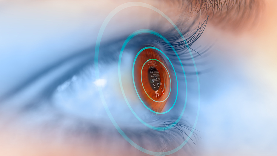 Glaucoma and Ocular Pressure