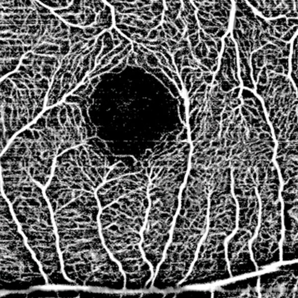 Huvitz H Angio Module Angiography Module