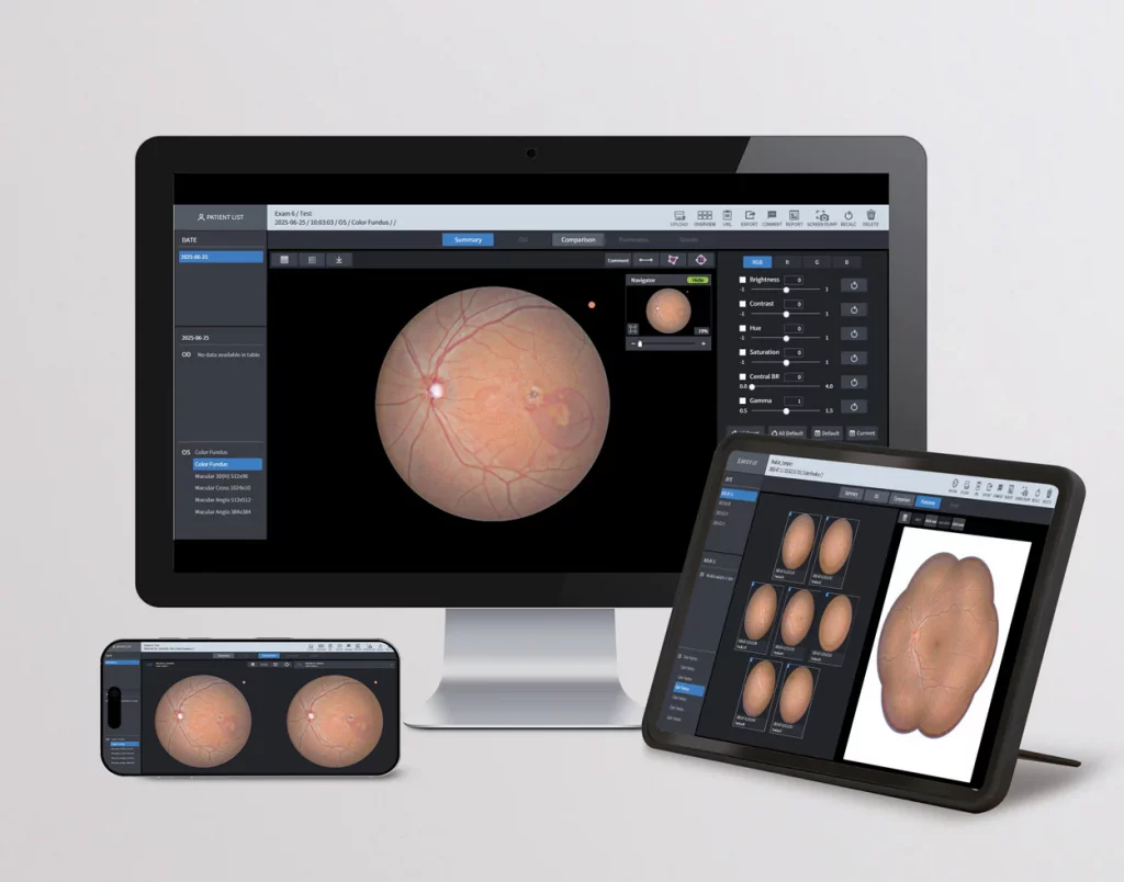 Huvitz Fundus Camera HFC-1 – image 11