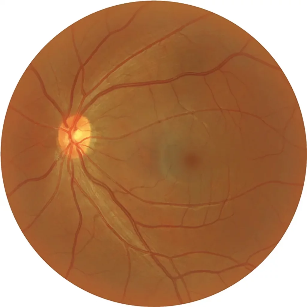Huvitz Fundus Camera HFC-1 – image 8