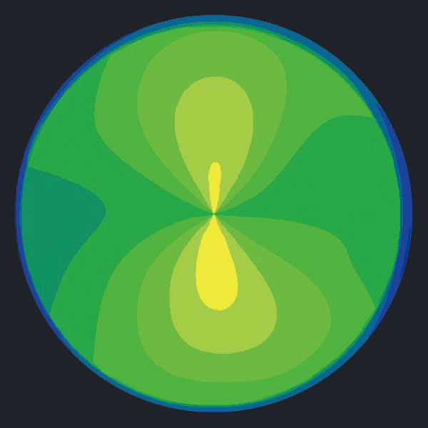 Huvitz HOCT-Topography Module