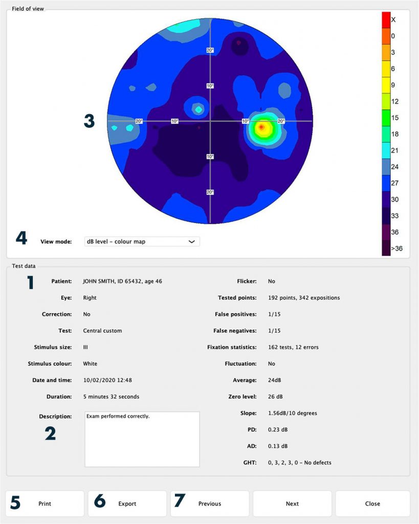Frey Perimeter AP-600 – image 5