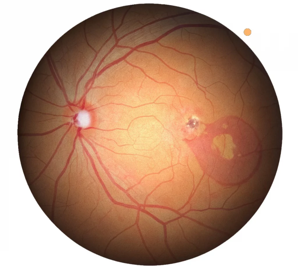 Huvitz Fundus Camera HFC-1 – image 3