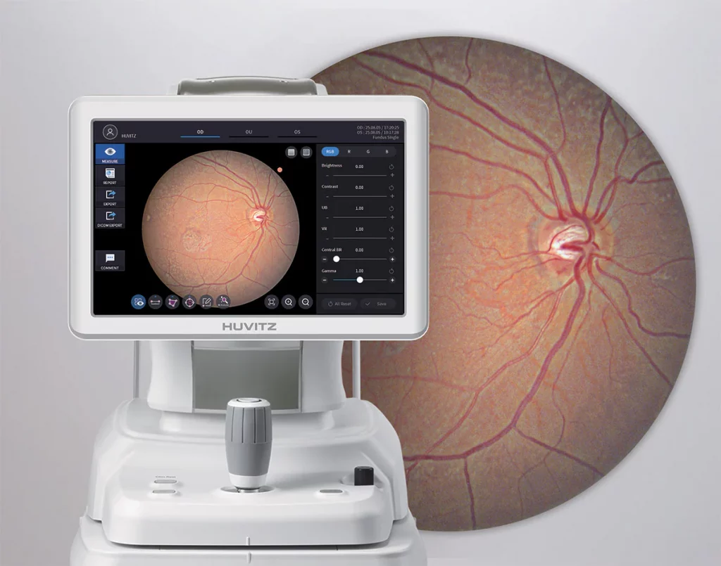 Huvitz Fundus Camera HFC-1 – image 7