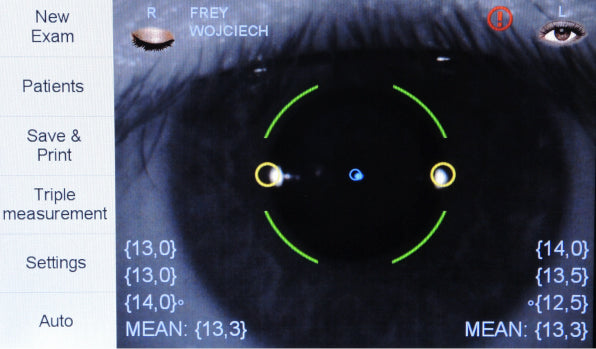 Frey Non-Contact Tonometer TN-100 – image 2