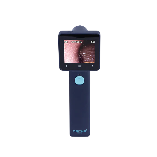 Ezer Digital Otoscope EZ-Horus OTO Blue
