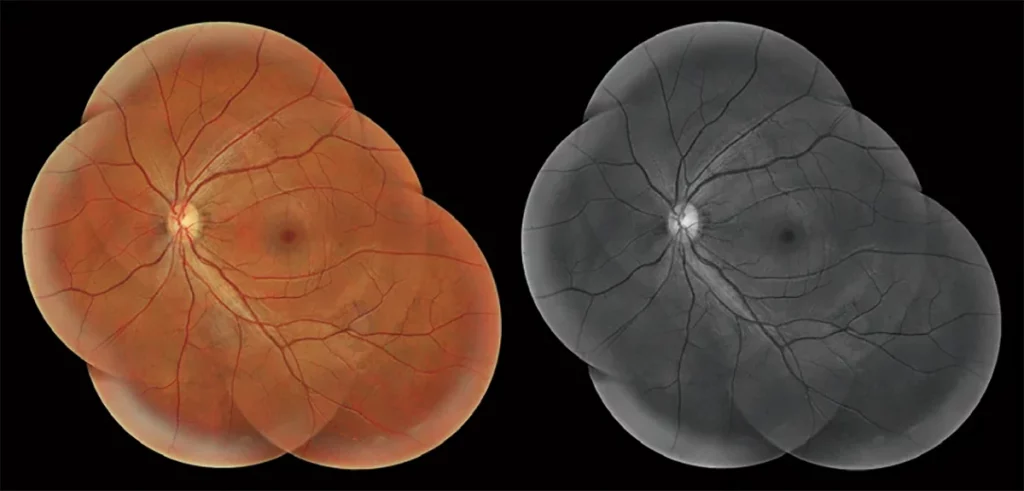Huvitz Fundus Camera HFC-1 – image 5