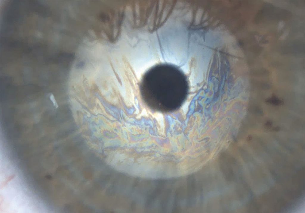 Ezer Dry Eye Sapphire A – image 1