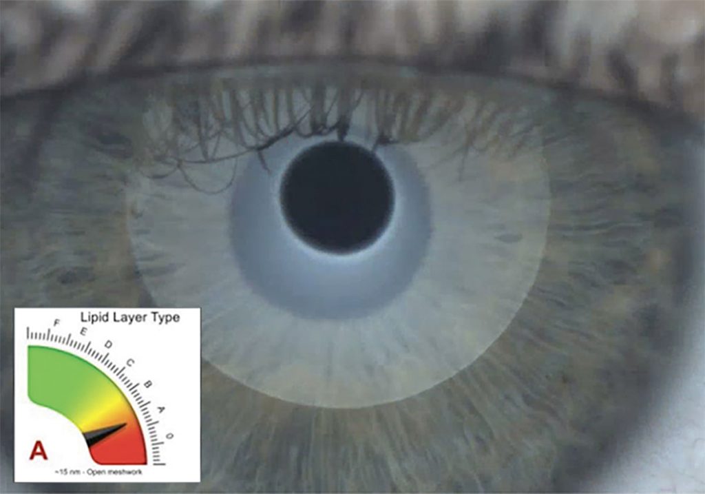 Ezer Dry Eye Sapphire A – image 2