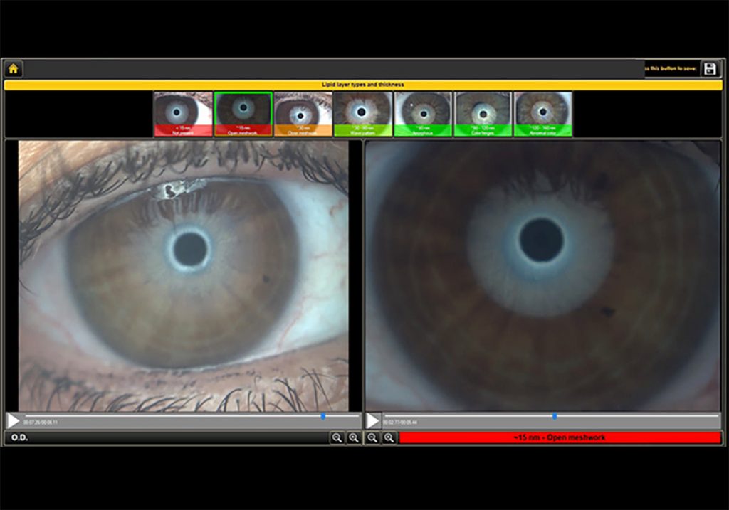 Ezer Dry Eye Sapphire A – image 3