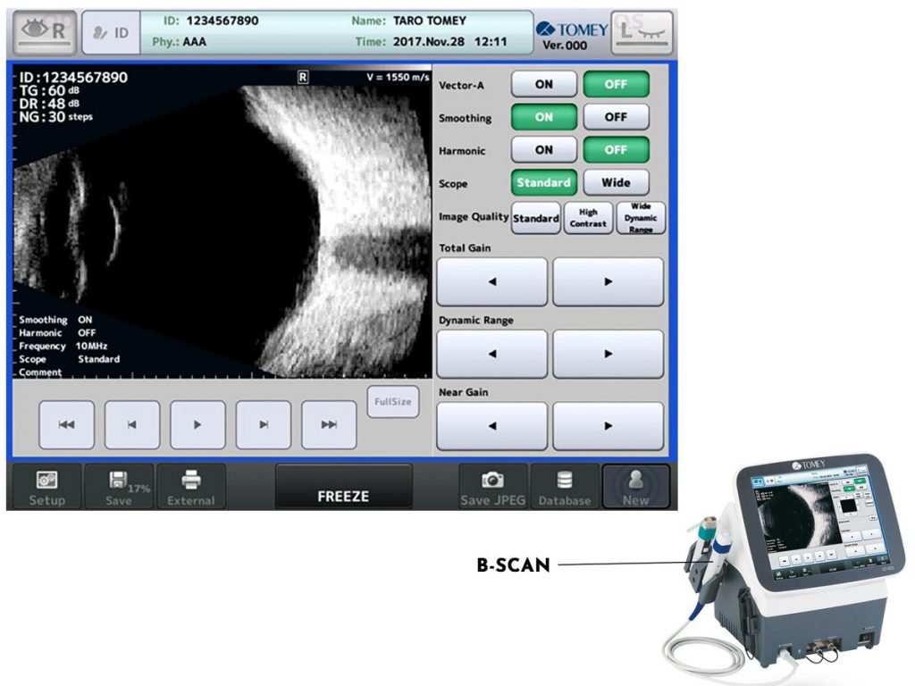 Tomey AB Ultrasound UD-800 – image 2