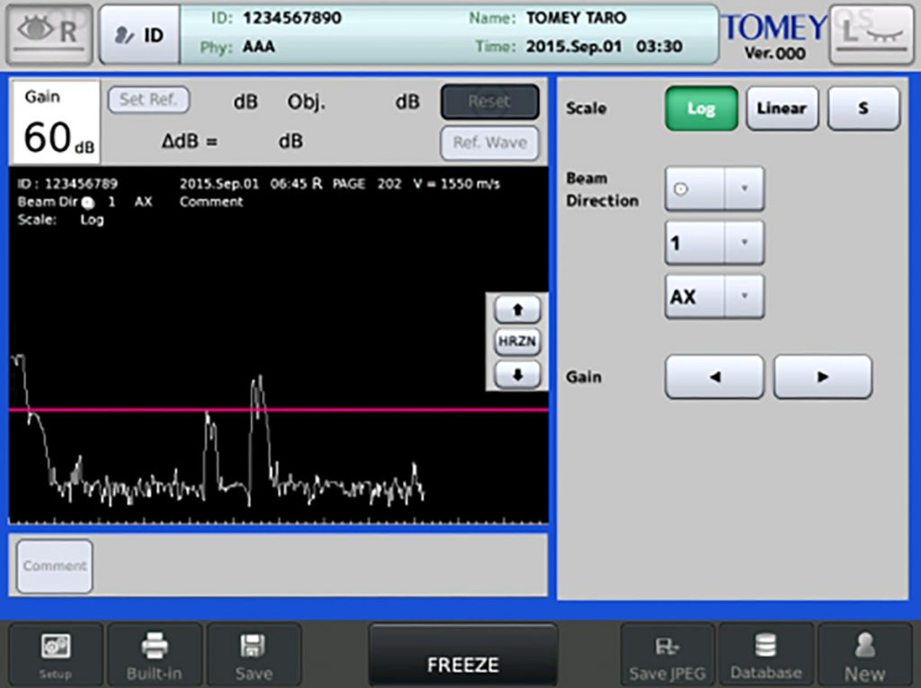 Tomey AB Ultrasound UD-800 – image 4