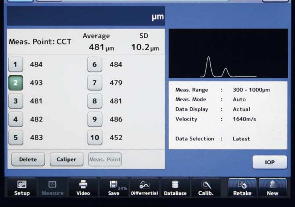 Tomey AB Ultrasound UD-800 – image 5