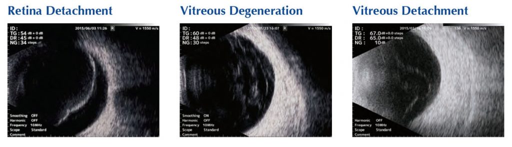 Tomey AB Ultrasound UD-800 – image 3