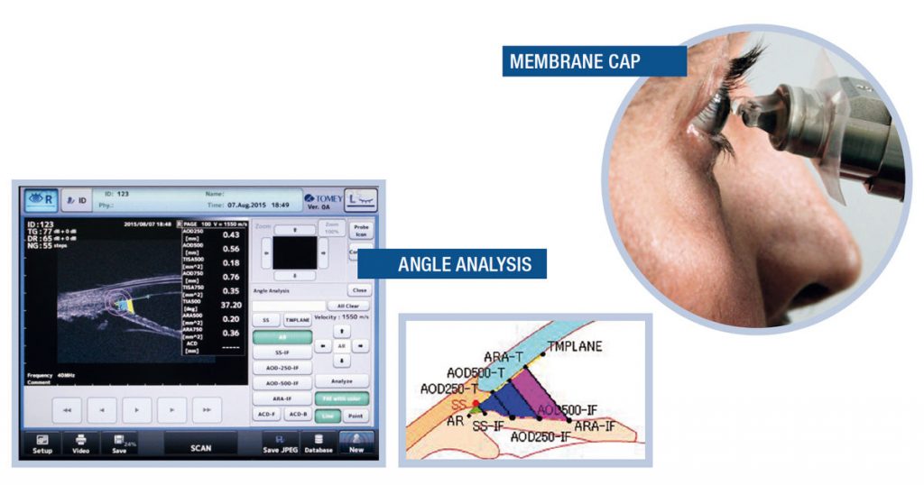 Tomey AB Ultrasound UD-800 – image 6