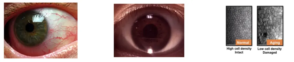 Ezer Anterior Segment Lens EZ-Horus Anterior Lens AF – image 1
