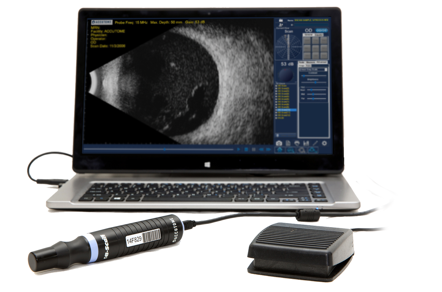 Accutome B-Scan Plus