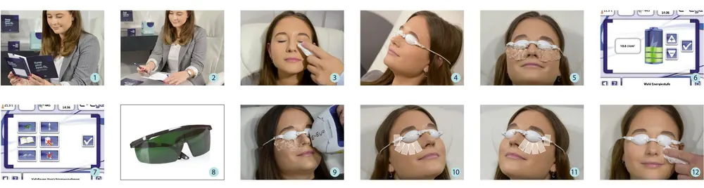 E-SWIN E-EYE IRPL Treatment IRPL