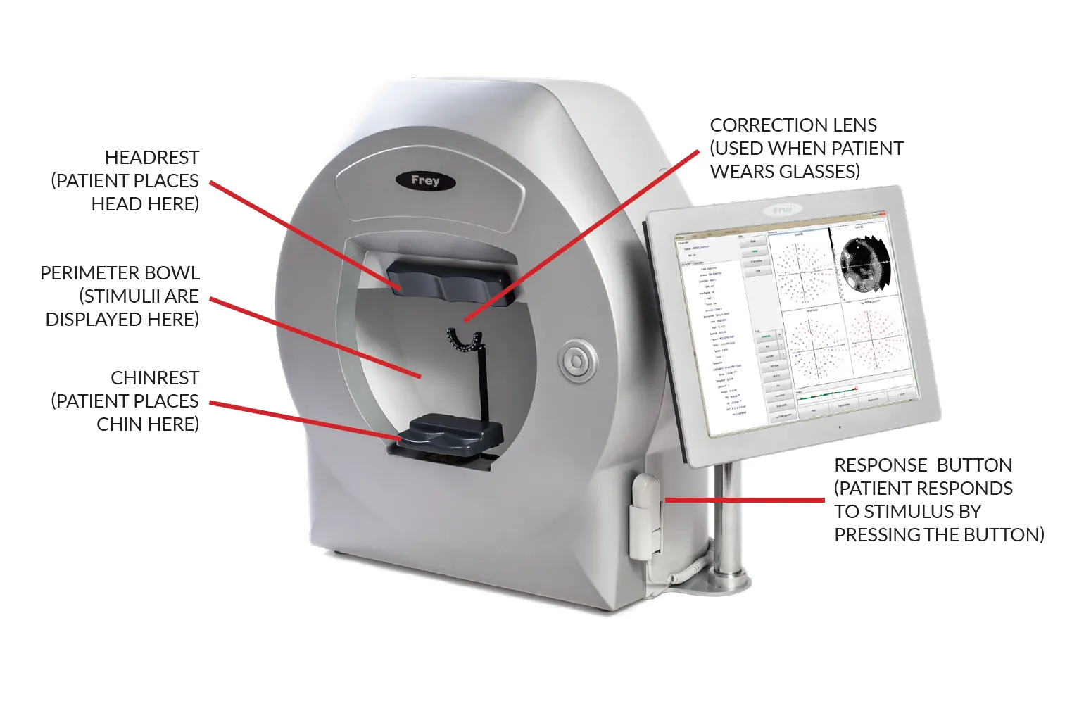 HOW PERIMETRY TEST IS CONDUCTED?