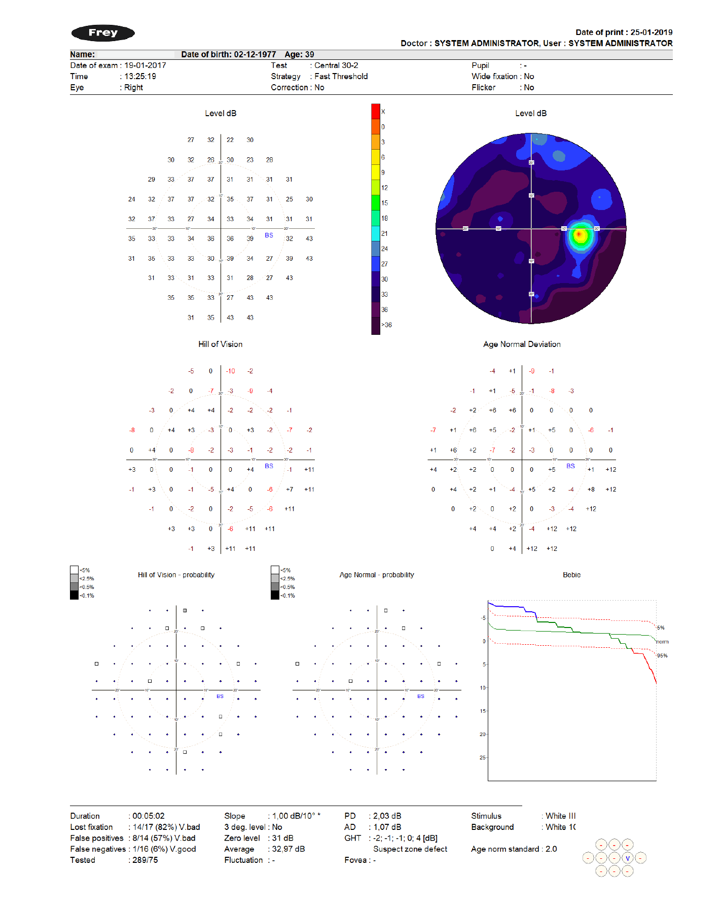 TEST RESULTS OPHTALMOLOGIC